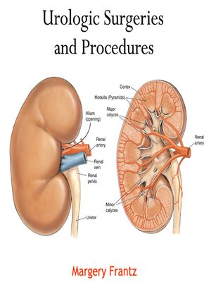 cover image of Urologic Surgeries and Procedures